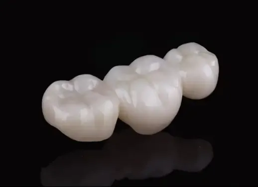 Zirconia All-Ceramic Crowns And Bridges Have No Irritation Or Allergic Reaction To The Gums photo-4