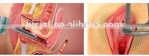 Popular Model F7+ Beauty Device Fractional Co2 Laser Vaginal Tightening photo-6