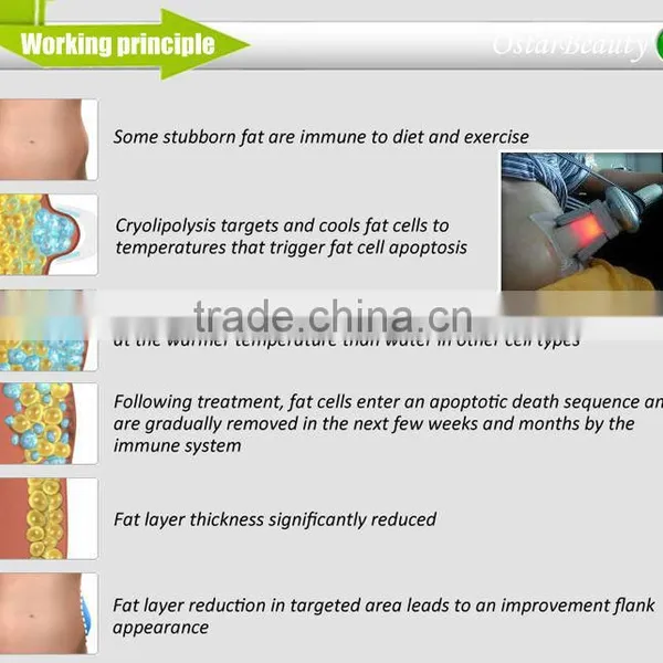 Hot Sale Freezing Fat Slimming Machine Medical photo-5
