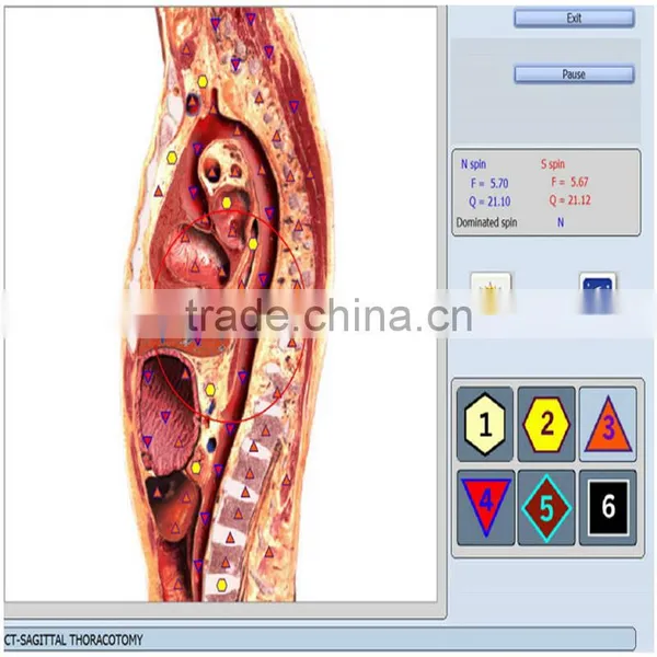 Factory Price Original 9d Cell Nls Health Analyzer 9D NLS Body Health NLS photo-3