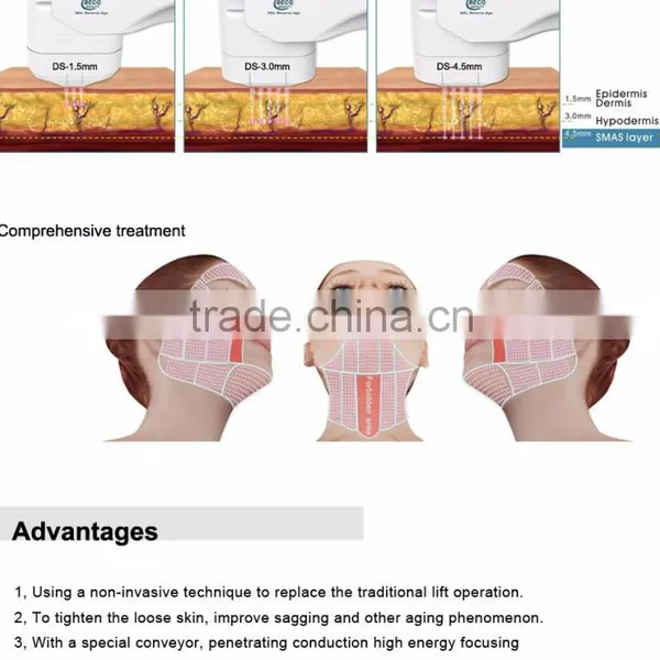 5.0-25mm 2016 New Portable Hifu Skin Tightening Machine/ Salon Use HIFU / 1.5mm 3.0mm 4.5mm/skin Tightening Hifu Beauty Machine Chest Shaping photo-5