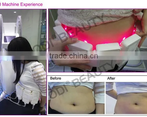 Hot Sale! Short Treatment Time but Good Result Lipolaser 650nm Laser Slimming Machine photo-6