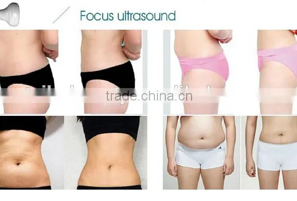 The Multifunctional and Effective Portable HIFU Focused Ultrasonic Fat Removal for Beauty Center and Clinic photo-5