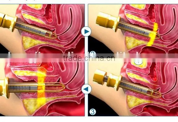 0.1mj-300mj Facial Skin Lifting And Tightening Fractional Co2 Laser/vaginal Tightening Co2 Laser Machine Eye Wrinkle / Bag Removal photo-5