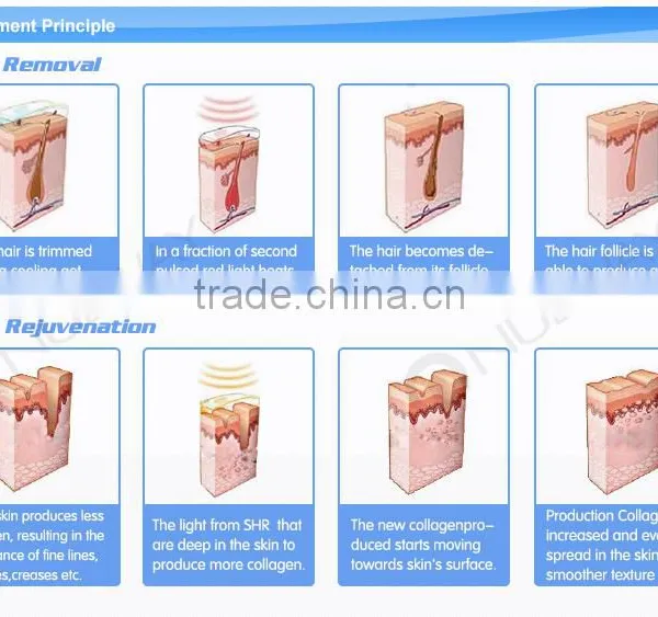 Skin Guardian!! IPL Laser Hair Removal / IPL Skin Rejuvenation Machine Price / IPL Machine Price With CE photo-5