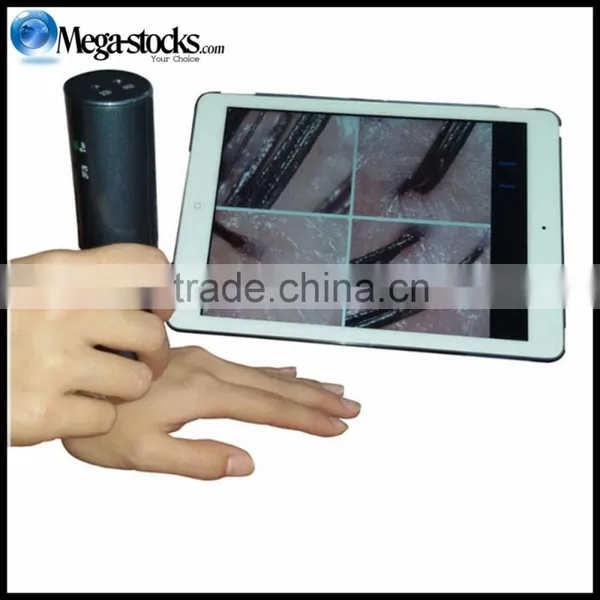 2MP 600X HD Scalp Detector, Hair Detector, Skin Detector, Wireless WiFi Connection Phone Tablet Hair Analyzer photo-3