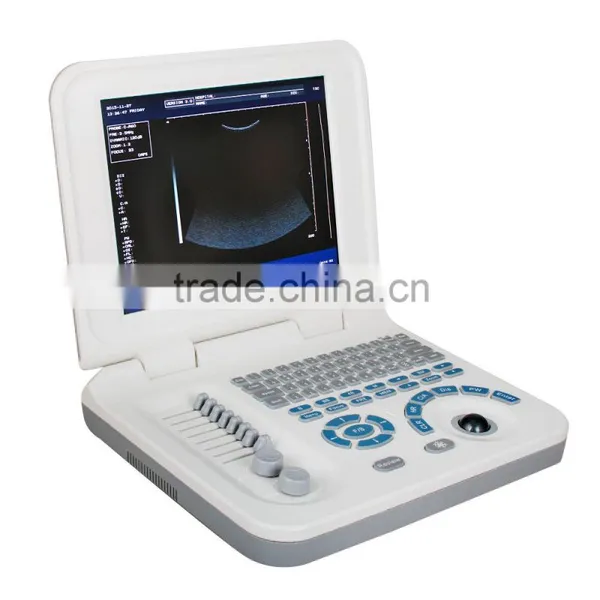 RUS-9000F2 CE Approved Hot Selling Digital Handheld Ultrasound Machine Medical Equipment-Shelly photo-3