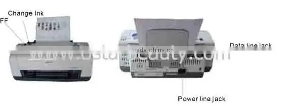 Two Years Warranty Body Analyzer System Ostar Beauty CE/ISO Approval HA 01 photo-4