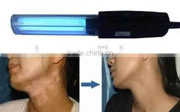2015 Derma 1 Series 311nm Lamps,UVB Therapy Lamp--- Vitiligo photo-2