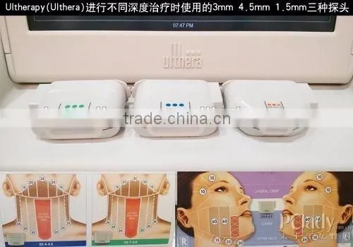 Medical CE Approval Wrinkle Removal to be Younger Professional Face Lift Hifu photo-4