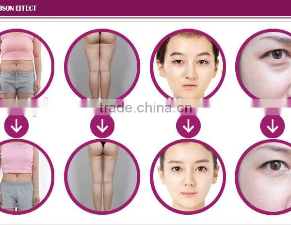 2016 New Type Body Shape Machine With CE photo-6