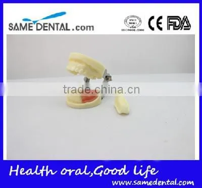 Dental Implant Practice Model DEA-31 Teeth Implant Models photo-2