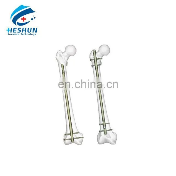 Femoral Intramedullary Nail Set