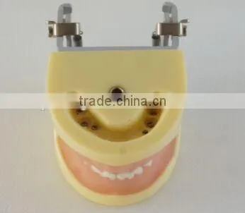 Pediatrics Typodont Teeth Model (20 Teeth) With Removable Screw Teeth photo-3