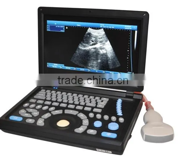 2016 New Laptop Ultrasound Machine / Scanner PC Platform With CE ISO Certification photo-2