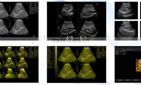 2016 New 3D Laptop Ultrasound Scanner (PC System) on Sale photo-6
