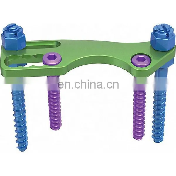 High Quality Orthopedic Surgery Implants Thoracic Screw for Anterior Thoracic Plate System photo-2