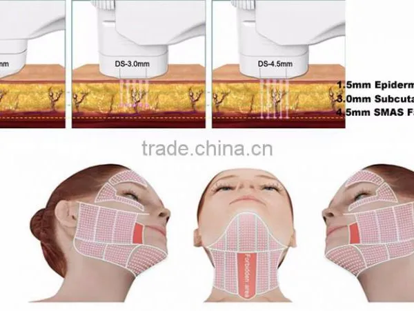Skin Tighten HIFU Machine!!! Vaginal Tightening HIFU /HIFU Hips Shaping Wrinkles Removal Machine For Sale Back Tightening photo-6