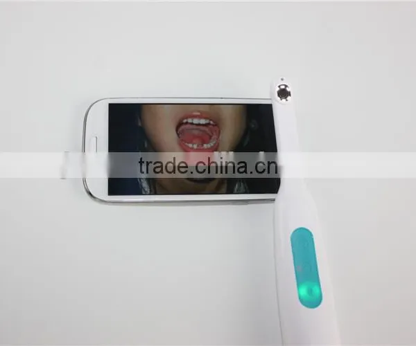 Home Using Detal Came With Wifi 720p Full hd Intra Oral hd Camera photo-6