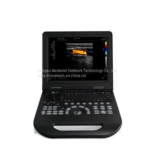 Notebook Color Doppler MDW-XFE30