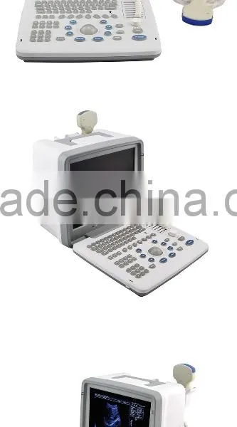 12-inch LCD Monitor 2 Probe Connector 1 USB Full Digital LED Portable Ultrasound Scanner for Sale photo-5
