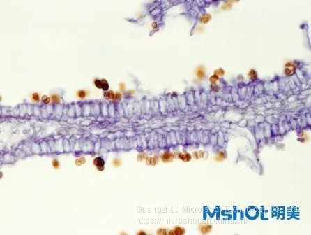 Routine Biological Microscope With Trinocular Observation Tube ML31 photo-2