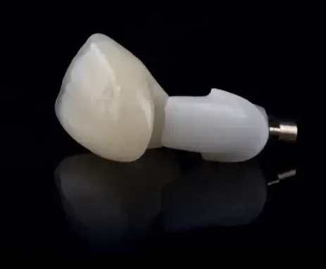 Denture False Teeth CAD/CAM Design Dental Laboratory Dental Restorations Dental Implant Restorations