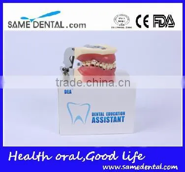 Dental Severe Periodontal Disease Model School Teaching photo-6