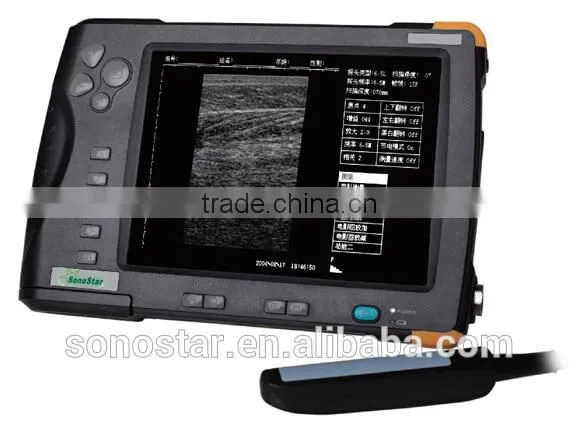 V5 Palm Ultrasound Scanner(ultrasonic,black White,Imaging Sys photo-2