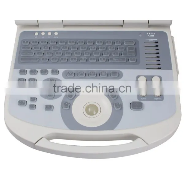 Cheap Price Portable Ultrasound Scanner With 3.5Mhz Convex Probe Manufacturer photo-5