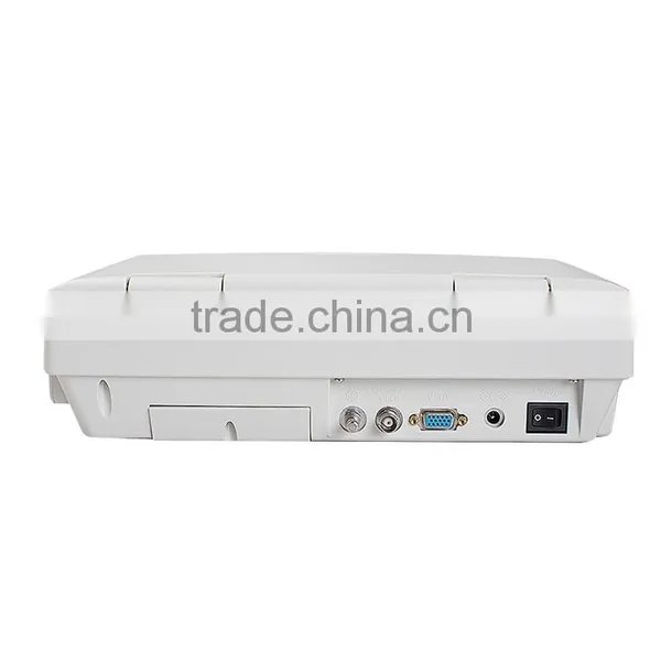 CE & ISO Full Digital Portable Ultrasound Machine Cheap Price PC Ultrasound Scanner for Human photo-5