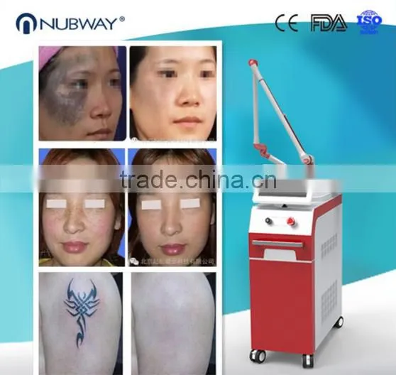 Q Switch nd Yag Laser Permanent Tattoo Pigment Removal Laser Nd Yag Q Switch photo-3