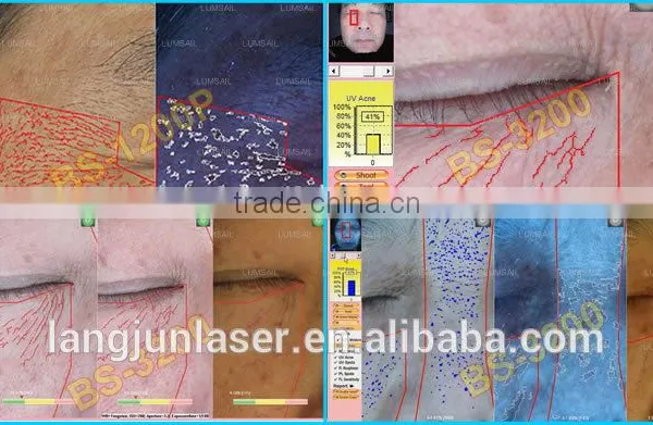 2016 Latest Amazing Magic Skin Analyzer, Skin Scope Analyzer photo-4