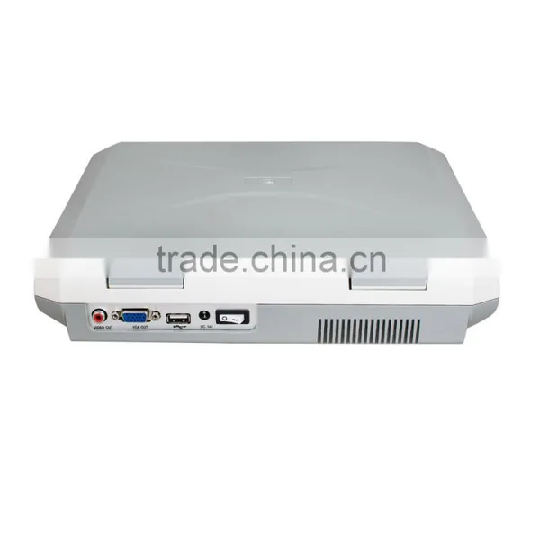 Quality Image Laptop Ultrasound Machine Scanner With Sony Printer/medical Use Ultrasonic Diagnostic-Large Screen10.4 Inch photo-6