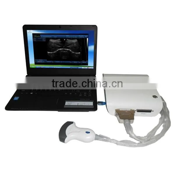 UBox-10 B/W Ultrasound Box photo-2
