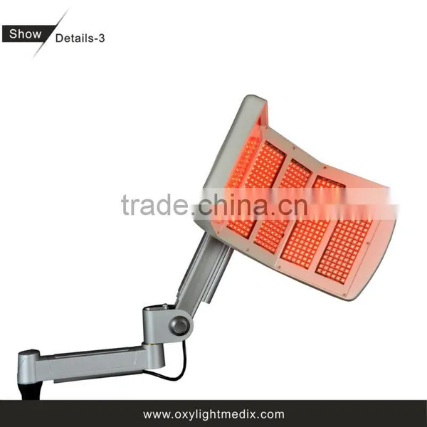 PDTbiolight Hot Sale Acne Treatment Machine (CE, ISO13485 Since1994) photo-5
