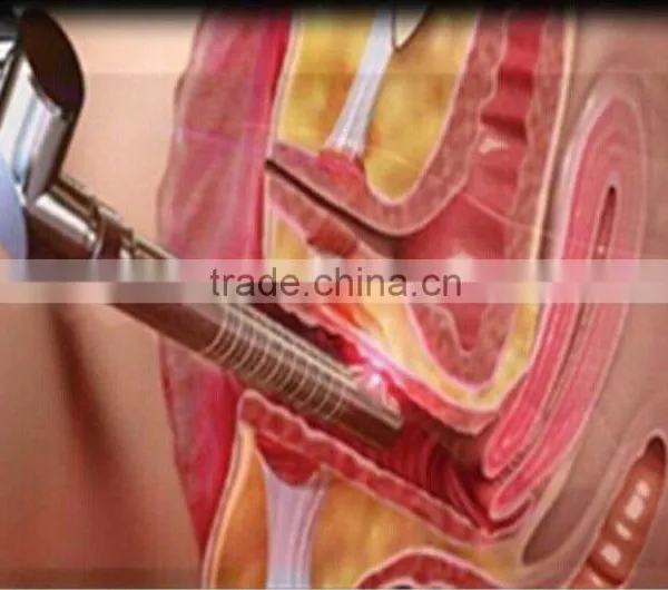 Fractional CO2 Laser Scar Removal Vaginal Tightening Facial Acne Pit Removal photo-4