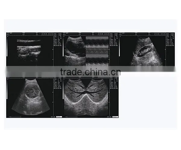 China Beijing 10.7 Inch Color LCD 2B Ultrasound Imaging System Laptop Ultrasound Scanner With CE ISO Approved photo-3