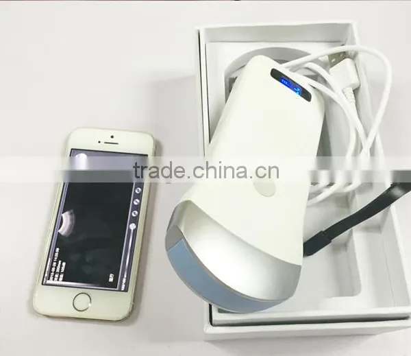 UltraSound Scanner, Convex Probe Ultrasound Scanner, WiFi, 3.5MHz / R40 / 64 Elements, SIFULTRAS-5.1 photo-5