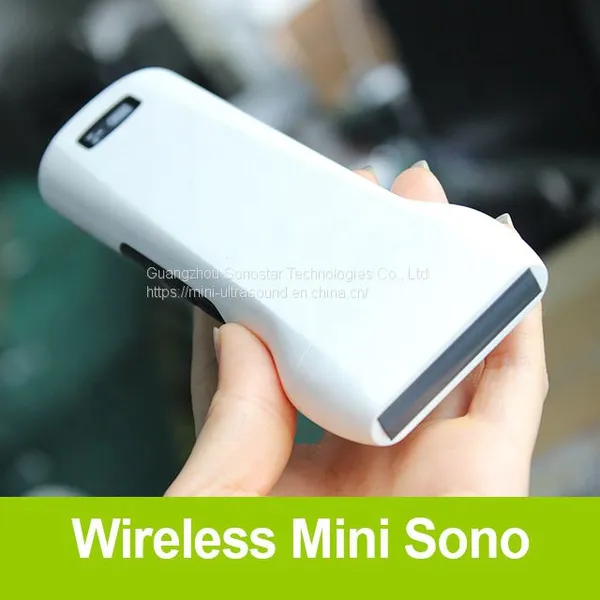 192 Element Handheld Wireless Pocket Ultrasound Scanner Probe Convex Linear