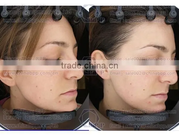 RGB and UV Spectrum Skin Analysis Camera for Analysis Skin Characteristic photo-5