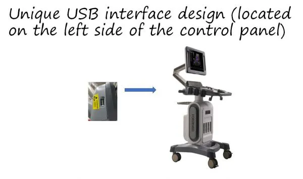 China Trolley 4D Color Doppler Ultrasound (YJ-U10T) photo-2