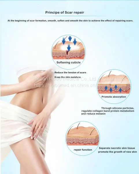 Silicone Gel Scar Patch，scar Repair Patch, Scar Removal Sheet, Silicone Scar Sheet, Medical Silicone Film Dressing, Scar Repair Patch，medical Scar Sheet photo-5