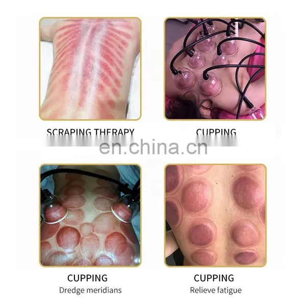 HOT Factory Vacuum Therapy Breast Enlargement Machine Vacuum Pump Butt Lift Breast Sucking Body Therapy Lymph Drainage photo-5