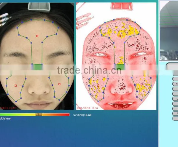 Langdy Facial Skin Analysis Machine Factory Direct Selling Price With CE photo-3