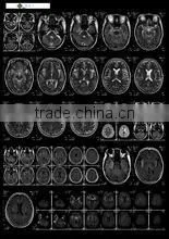 Konida Medical X-ray Film Agfa Fuji Dry Film/x-ray Automatic Medical Film Processor photo-2
