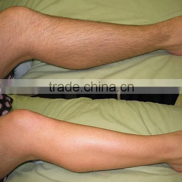 Multifunctional Low Price 808 Diode Laser Alma Laser Female Soprano Ice Laser Hair Removal Machine Ipl Shr photo-5
