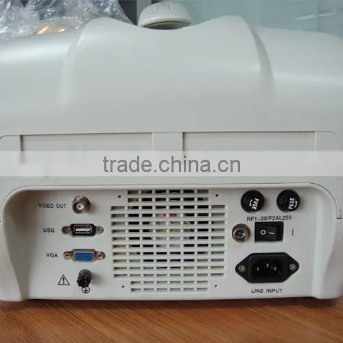 Digital Portable Ultrasound Scanner photo-6