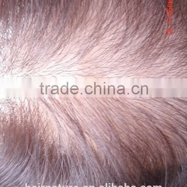 Injected Lace Hair Pieces photo-3