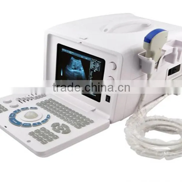 2016 New Digital Portable Ultrasound Scanner With High Quality and Low Price photo-6